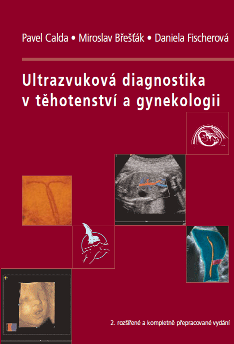 Ultrazvuková diagnostika v thotenství a gynekologii
